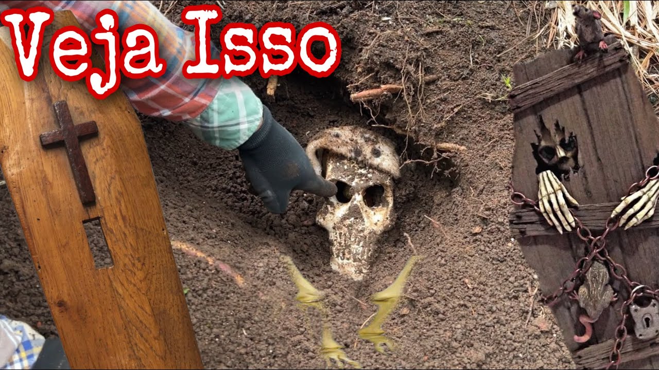Este caçador de Tesouro encontrou mais do que Esperava ,ouro dentro do Cr4nio