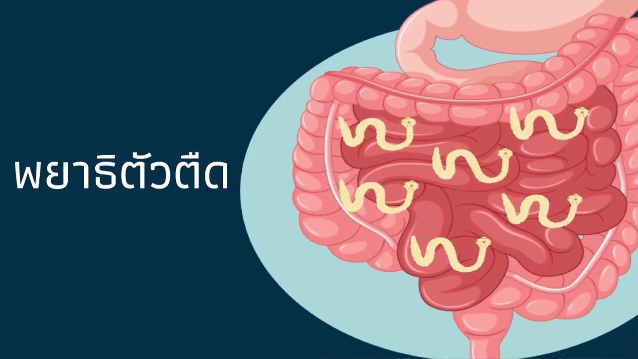 พยาธิตัวตืด [Tapeworms] | Taenia spp. | Parasitology, MD, KKU