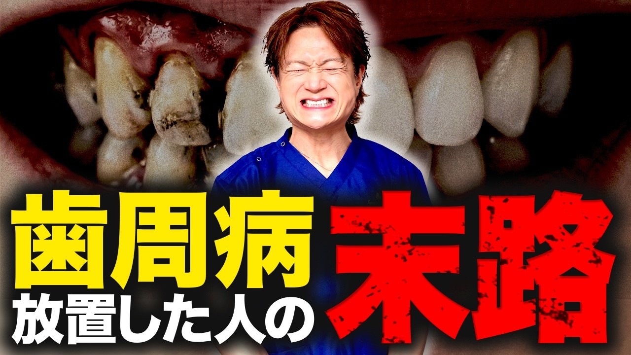 【後悔する前に】歯周病は自然に治りません。放置の代償を本音で話します