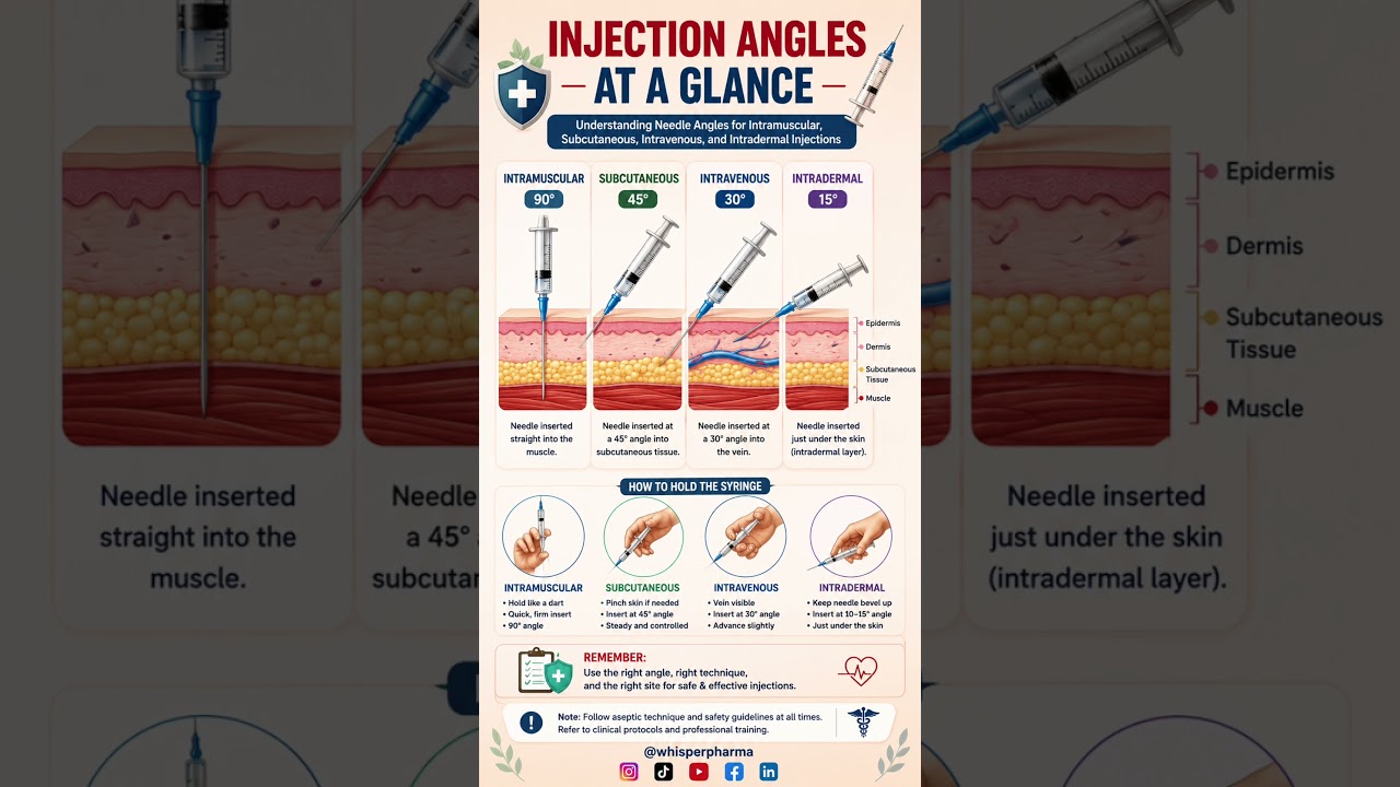 Injection Angles Explained: Intramuscular, Subcutaneous, Intravenous & Intradermal
