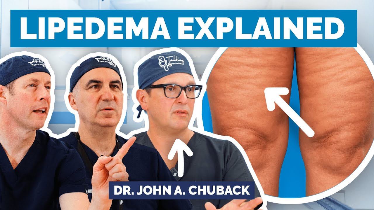 Lipedema vs Obesity: The Hidden Fat Disorder Doctors Miss