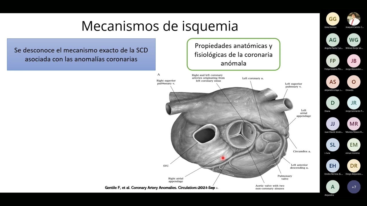 CFC | Conferencia: Diagn&oacute;stico y manejo del origen an&oacute;malo de la arteria coronaria derecha.