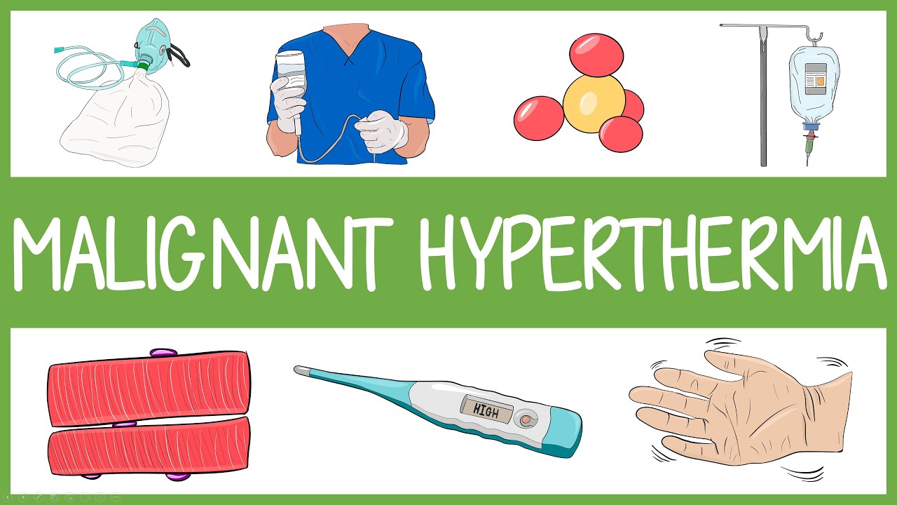 Malignant Hyperthermia in 3 Minutes