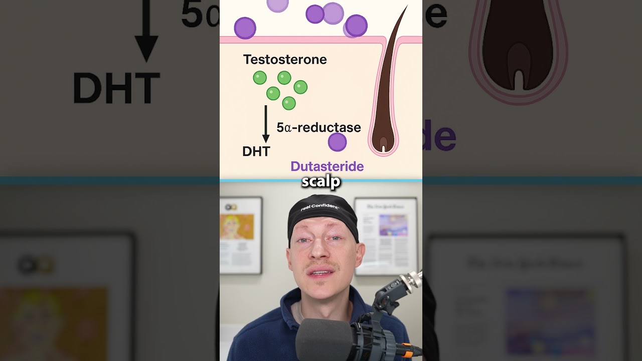 Hair Surgeon Answers Questions About Dutasteride