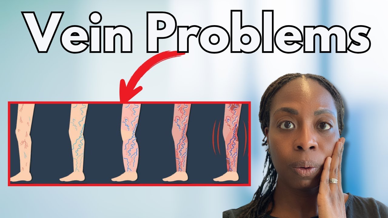 When a Leg Wound Won&rsquo;t Heal: Doctor Explains Venous Ulcers
