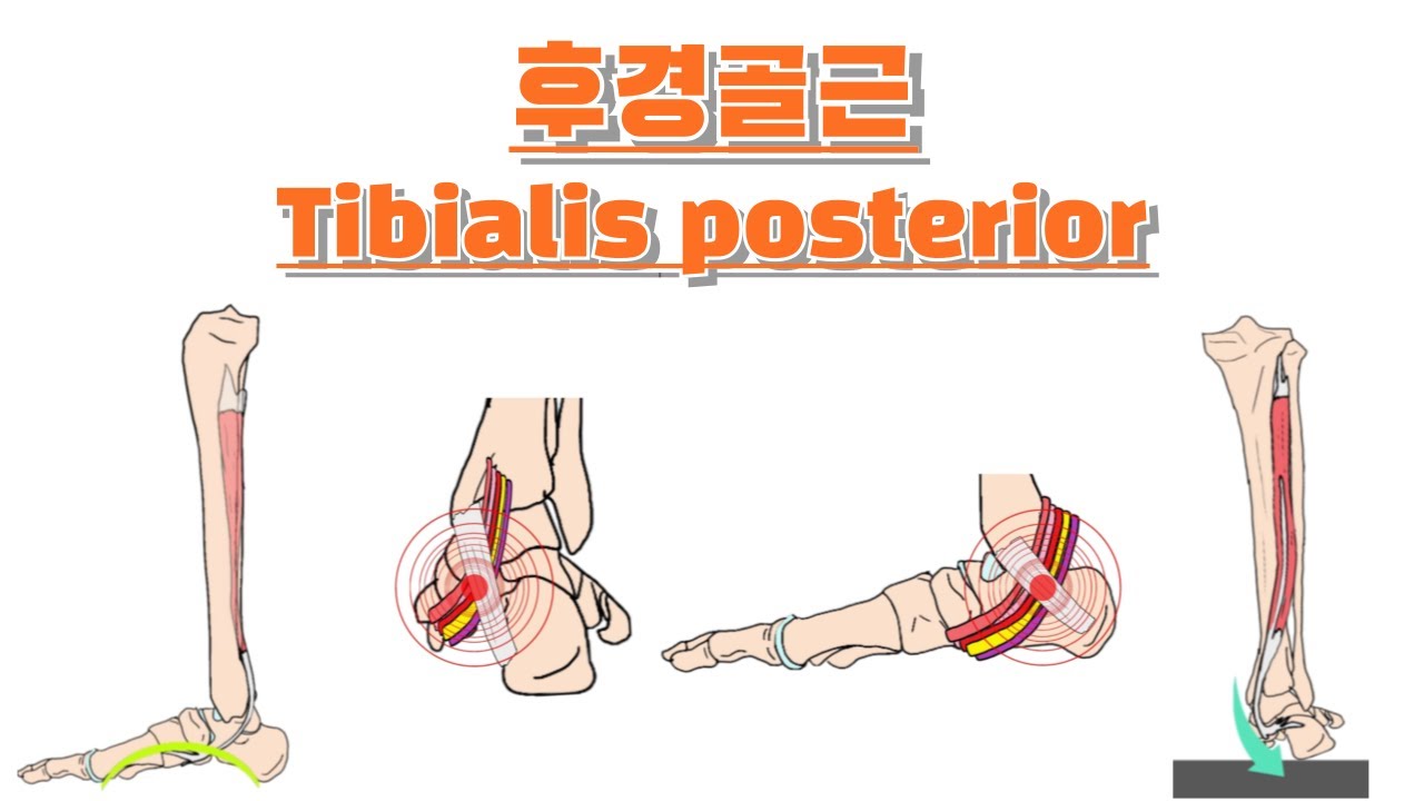 후경골근/뒤정강근/ Tibialis posterior 완전 정복!