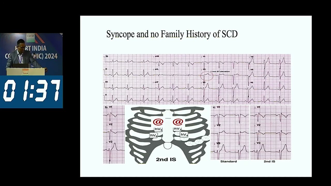 An Approach to A Case of Syncope - Dr Ashutosh Kumar
