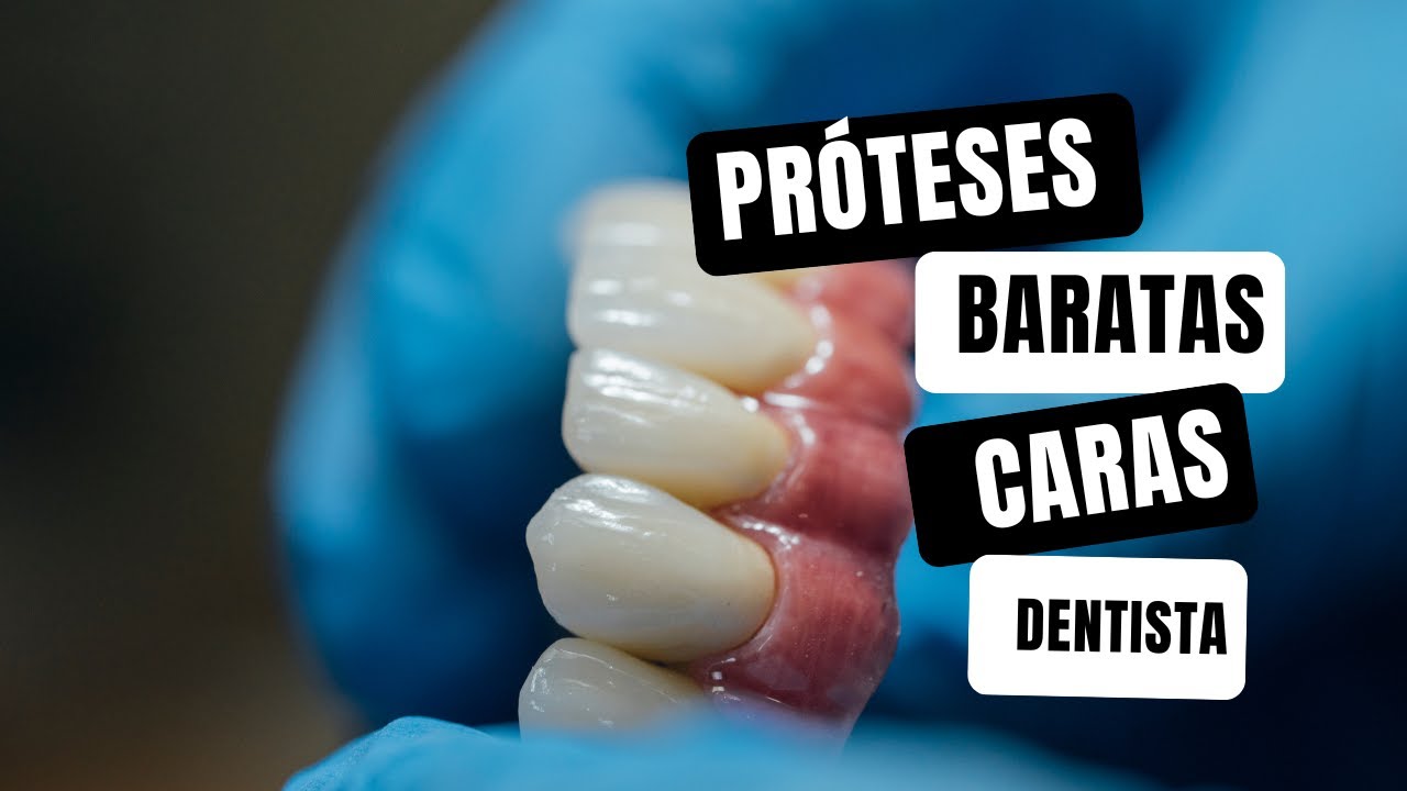 4 Tipos de Próteses fixas no dentista