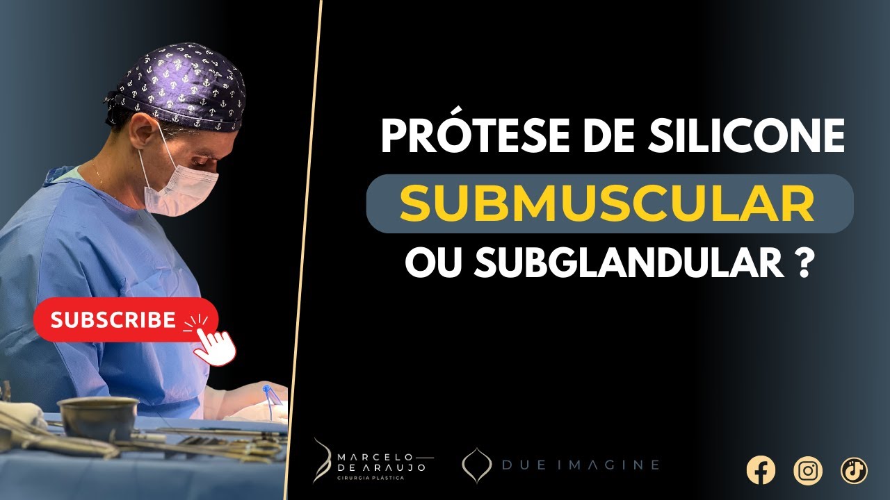 PR&Oacute;TESE DE SILICONE SUBMUSCULAR OU SUBGLANDULAR?
