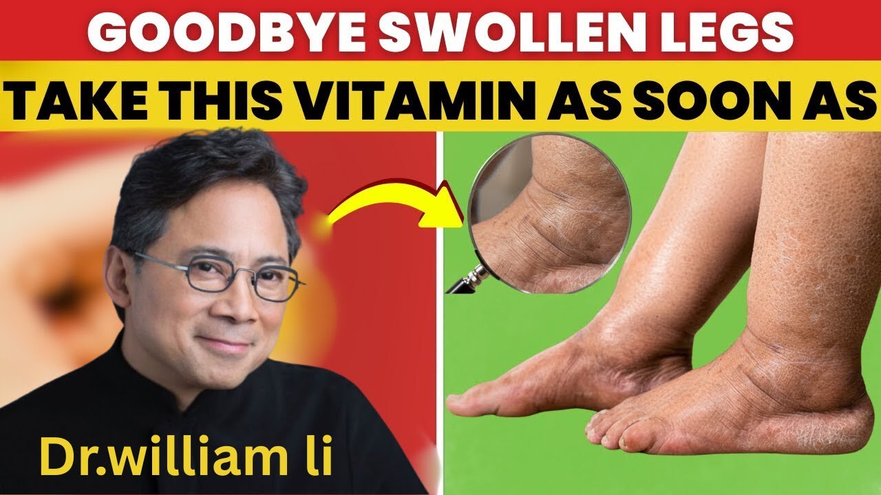 Swollen Legs & Ankles? Dr. Li Reveals the #1 Vitamin for Seniors That Works Fast.