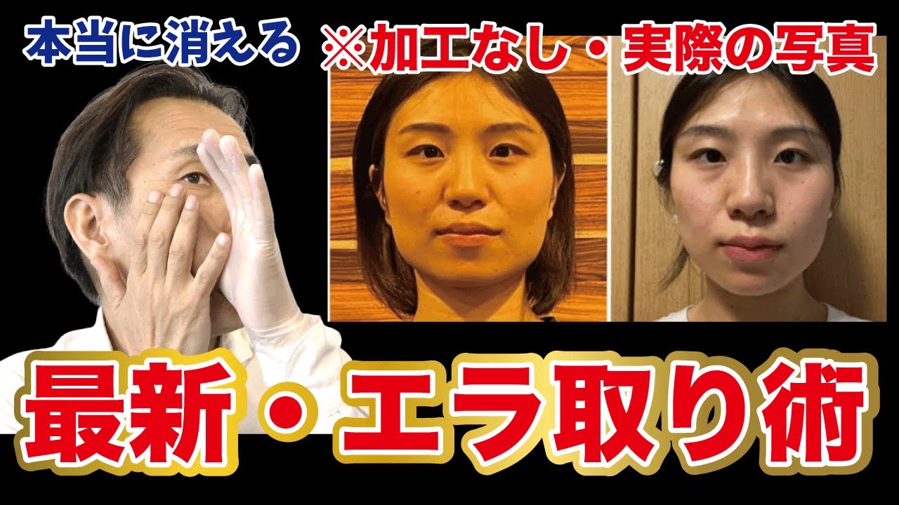 【有料級】ガチガチのエラ張り・食いしばりを１分で解消する整形級リンパケア