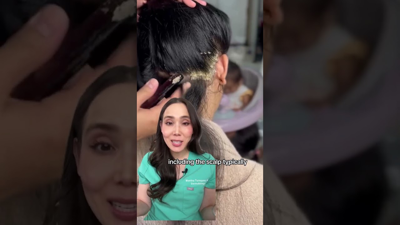 Derm Reacts to Scaly Scalp