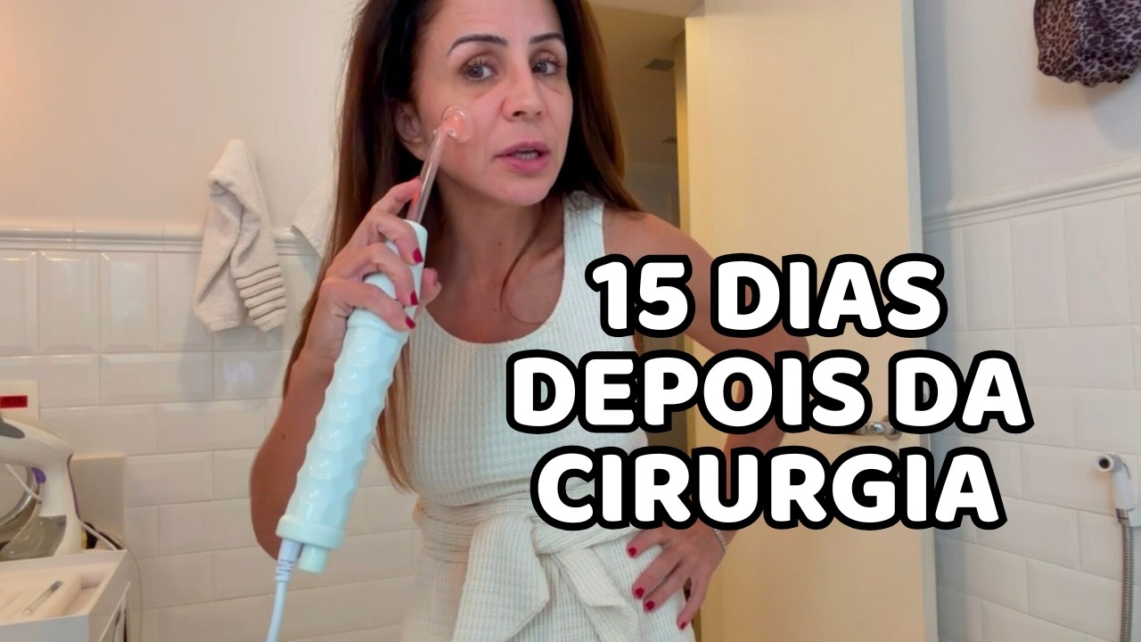 Minha Rinoplastia!