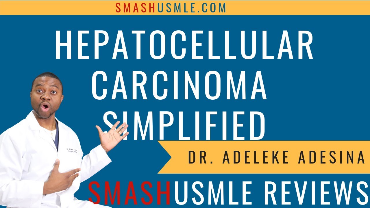 Hepatocellular Carcinoma Lecture Simplified