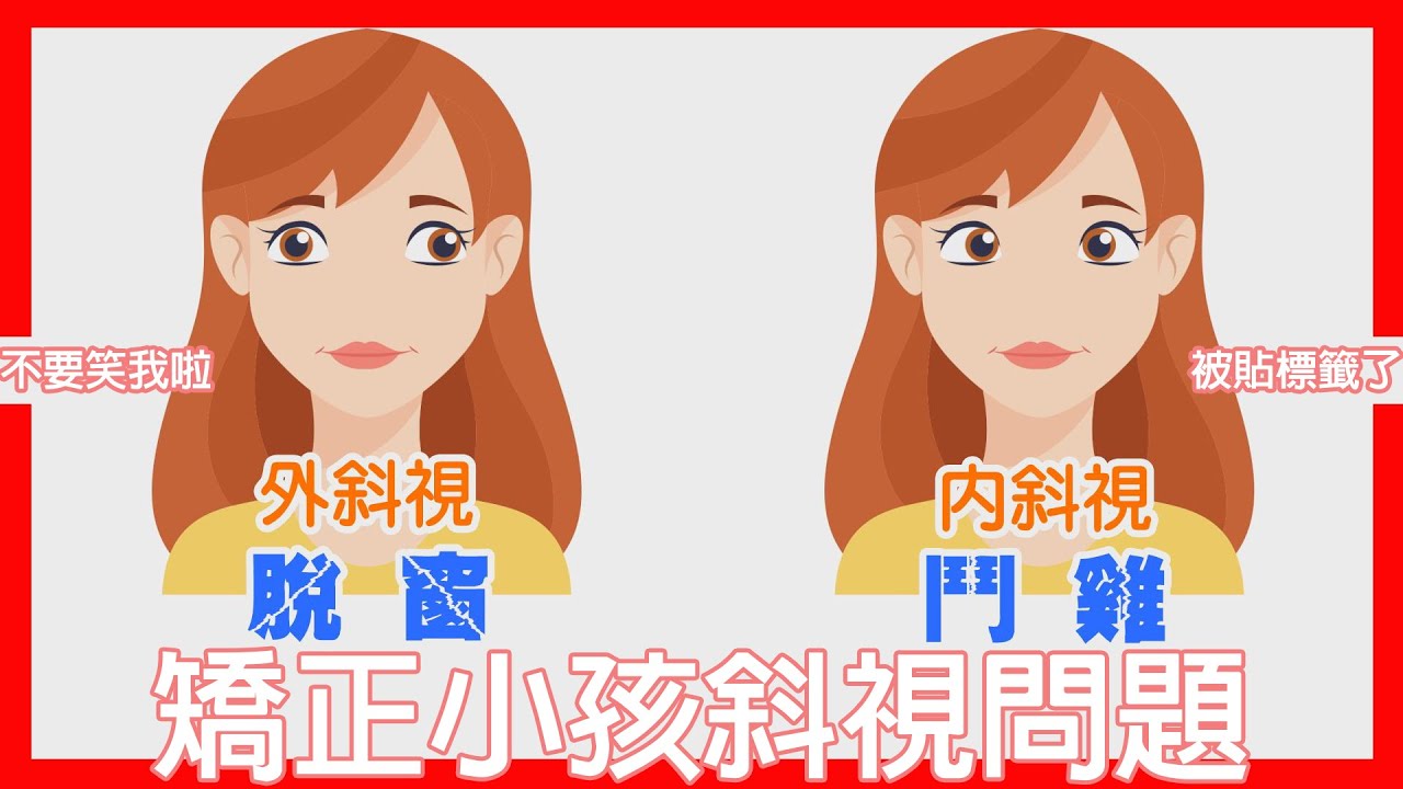 斜視是什麼？脫窗、鬥雞眼都是斜視的問題 【諾貝爾眼科帶你一解斜視的成因】