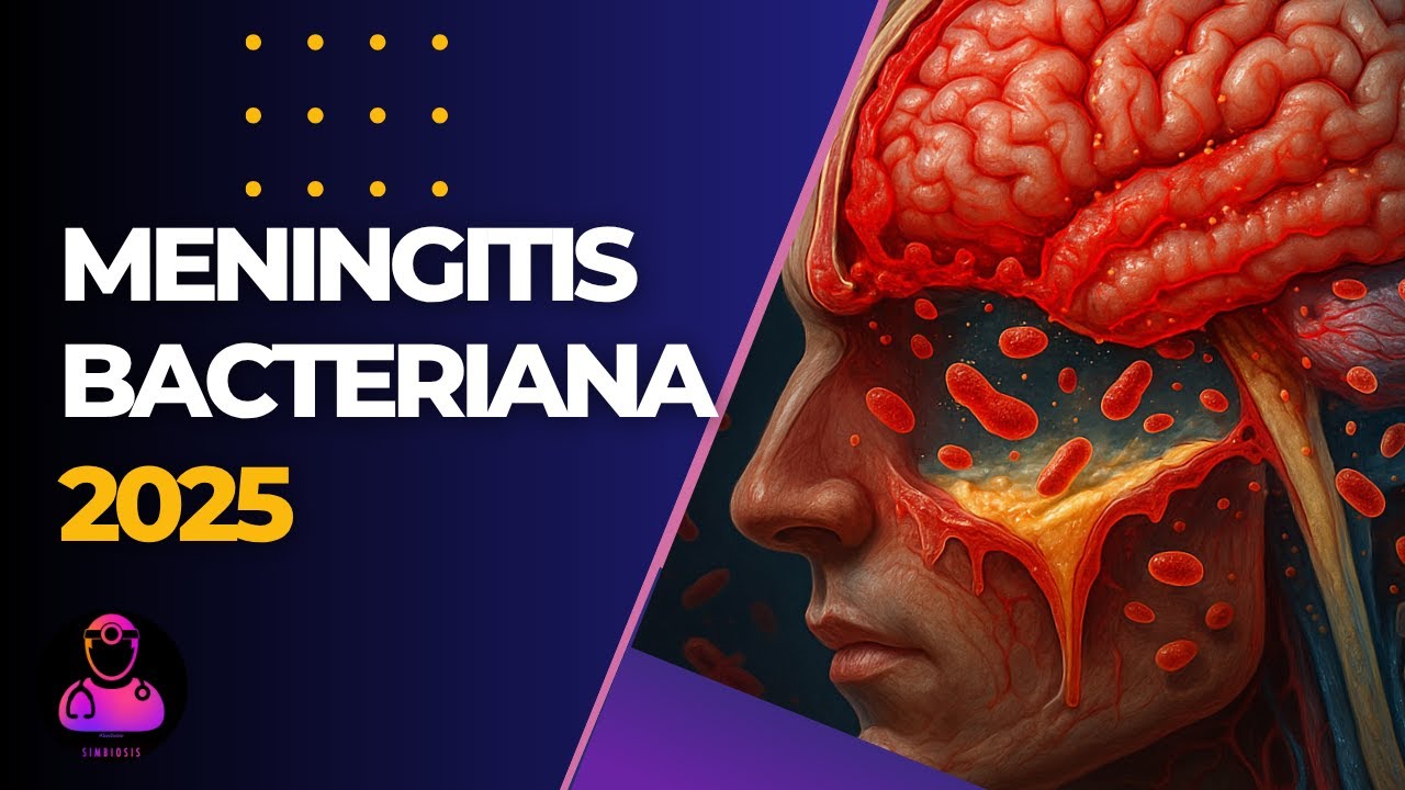 🧠Meningitis Bacteriana Aguda | 