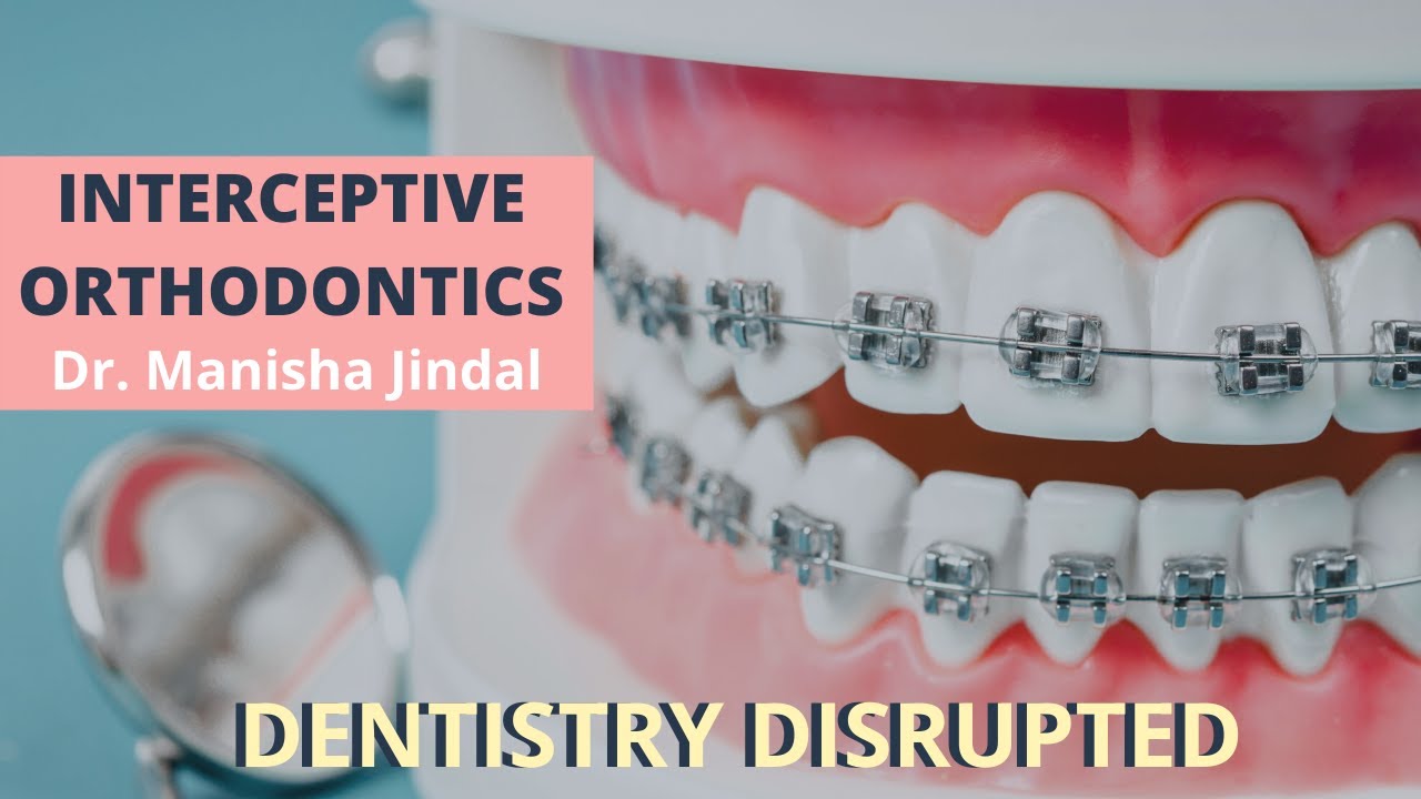 Interceptive Orthodontics