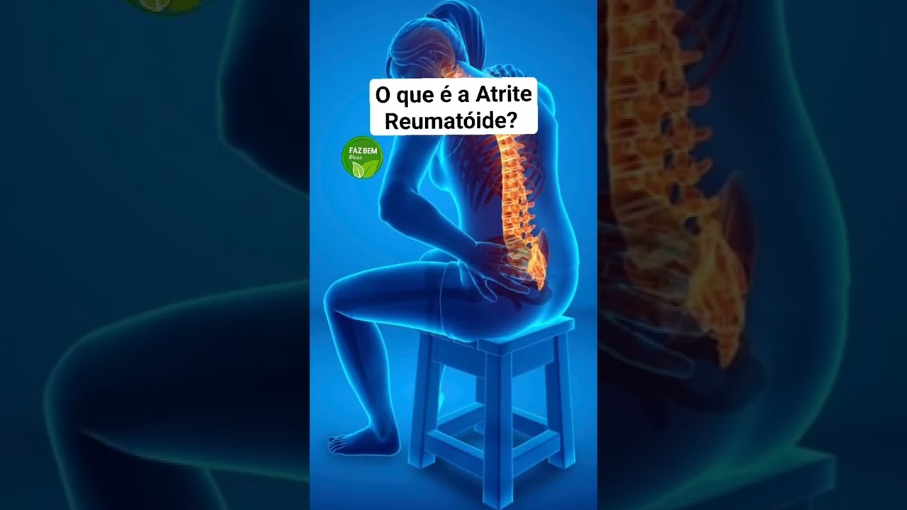 O que é a Artrite Reumatóide?