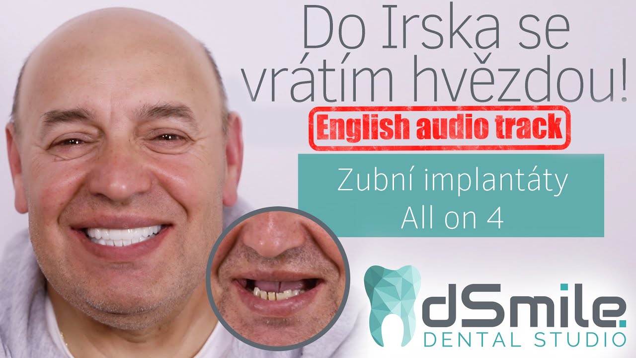 Jak probíhá implantace zubů během 1 dne?