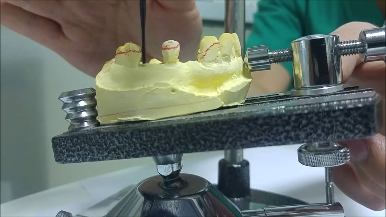 Análisis en Tangenciógrafo