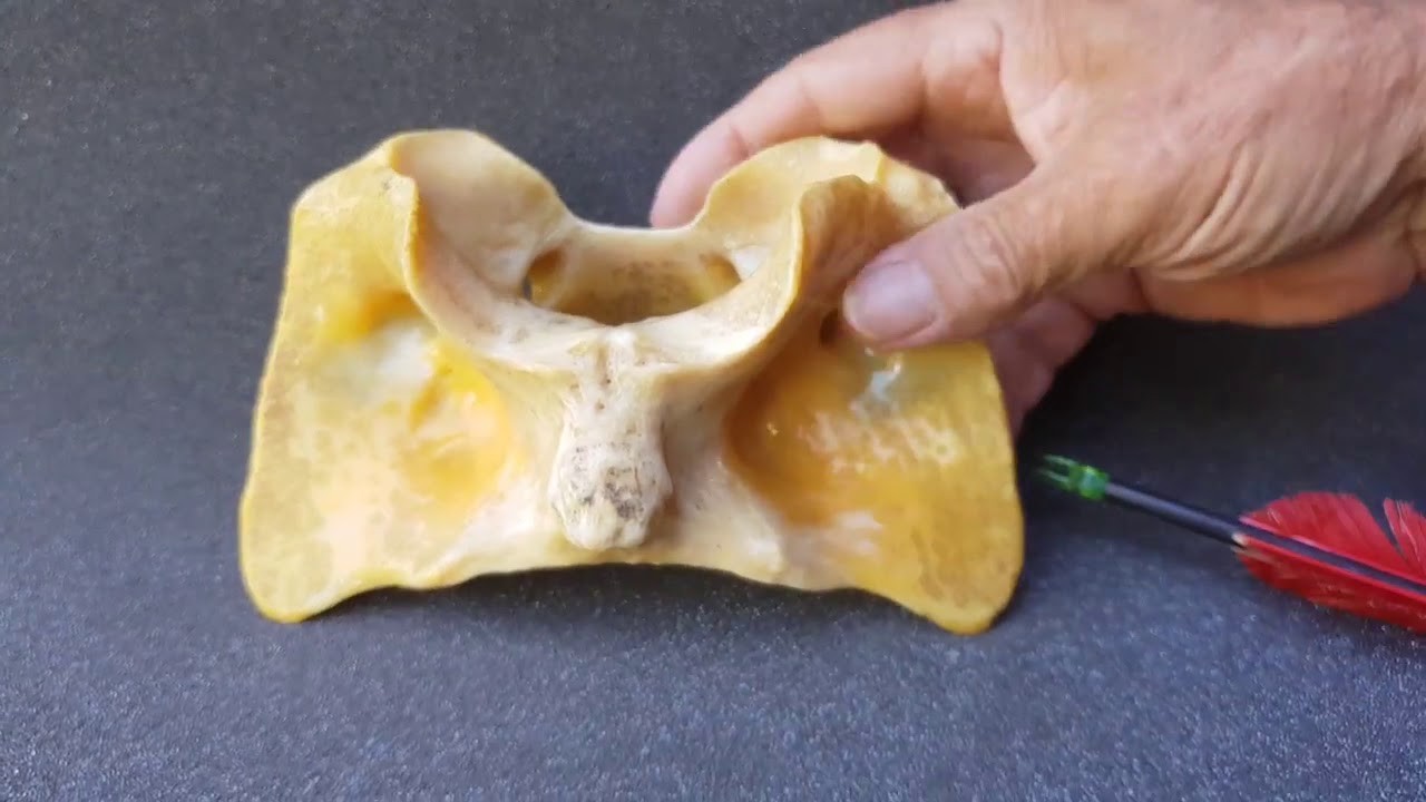 Anatomia Animal 1ª vertebra cervical Atlas