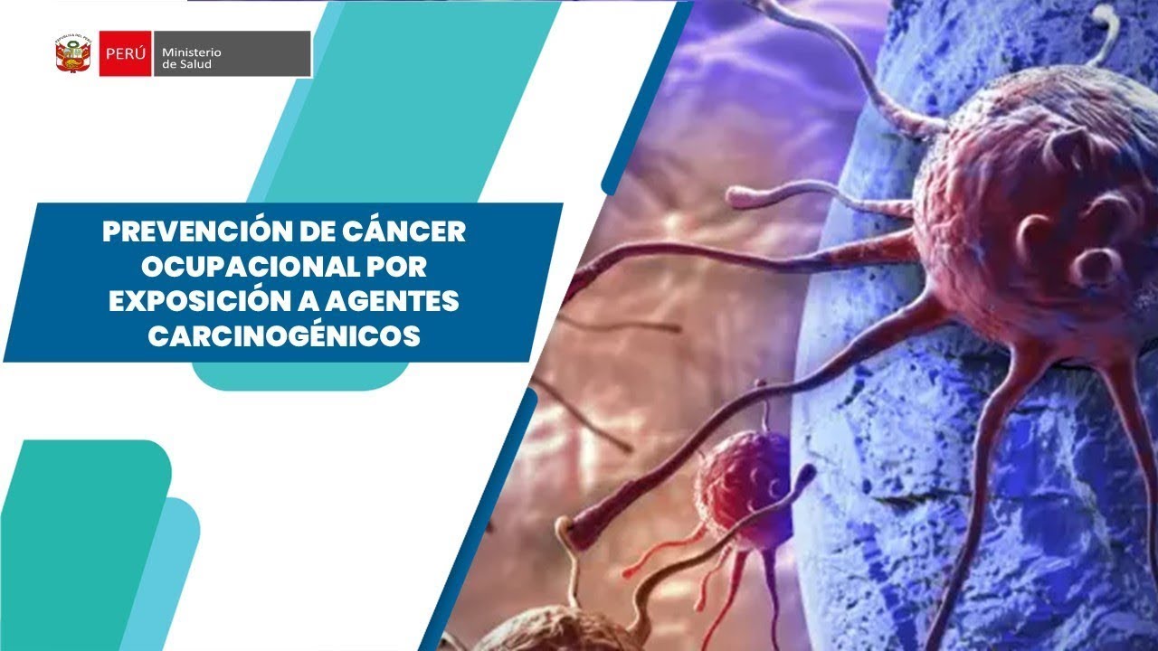 PREVENCION DE CANCER OCUPACIONAL POR EXPOSICION A AGENTES CARCINOGENICOS
