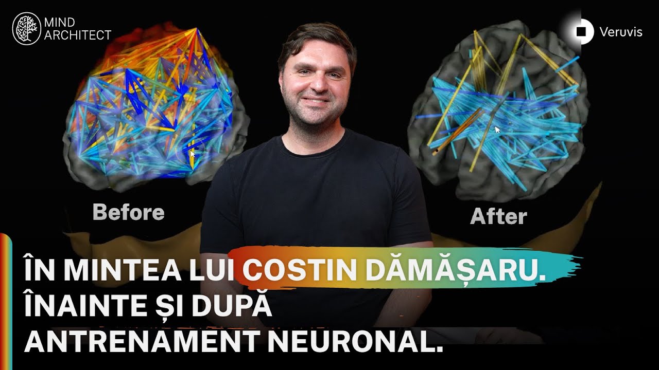 Antrenamente Neuronale: De la DISPERARE și DECONECTARE la o VIAȚĂ TRĂITĂ CONȘTIENT