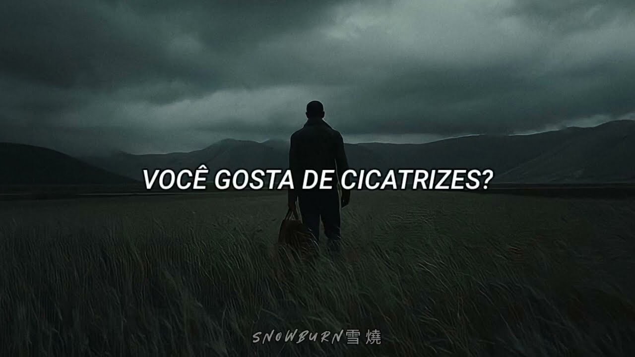 Michael Malarkey - Scars (Tradução/Legendado)