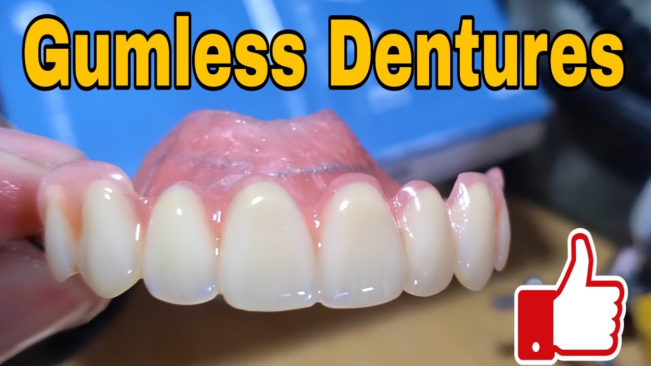 Plastic/Acrylic Dentures plastic na ngipin to Composite teeth NewAcePx Composite Resin Teeth