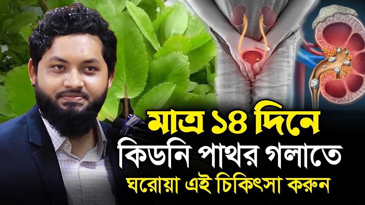 যে লক্ষনে বুঝবেন আপনার ক্লোন ক্যান্সার হয়েছে  | ডঃ নোবেল | Dr Nobel | কিডনি পাথর পাথরকুচি পাতা 