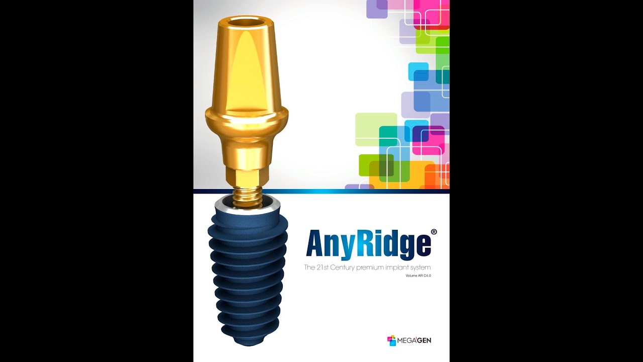 Implant dentar Megagen AnyRidge: caracteristici, pret, pareri, preturi