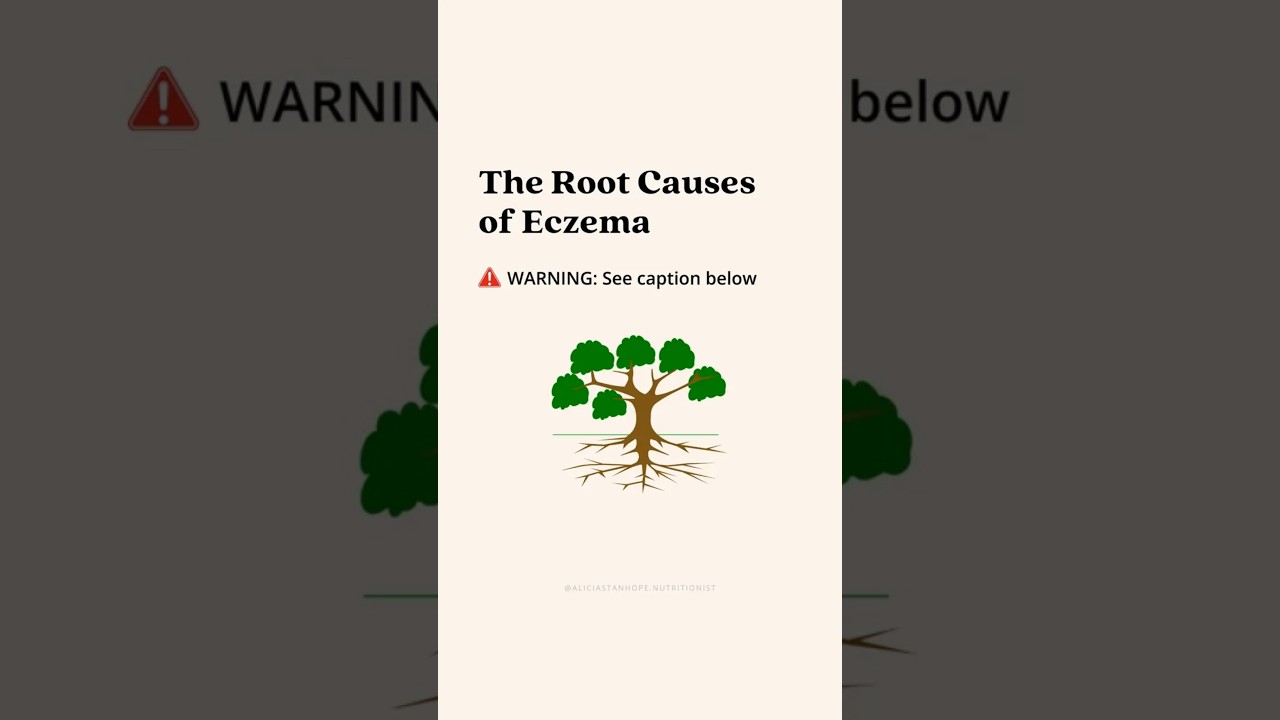 The Root Causes of Eczema⁣