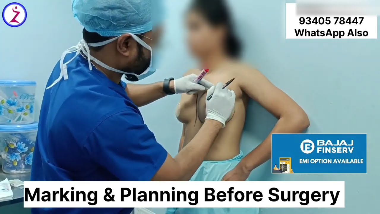 Gender Change Surgery In Kochi Trivandrum Kerala Chennai madurai coimbatore Salem Vellore Erode