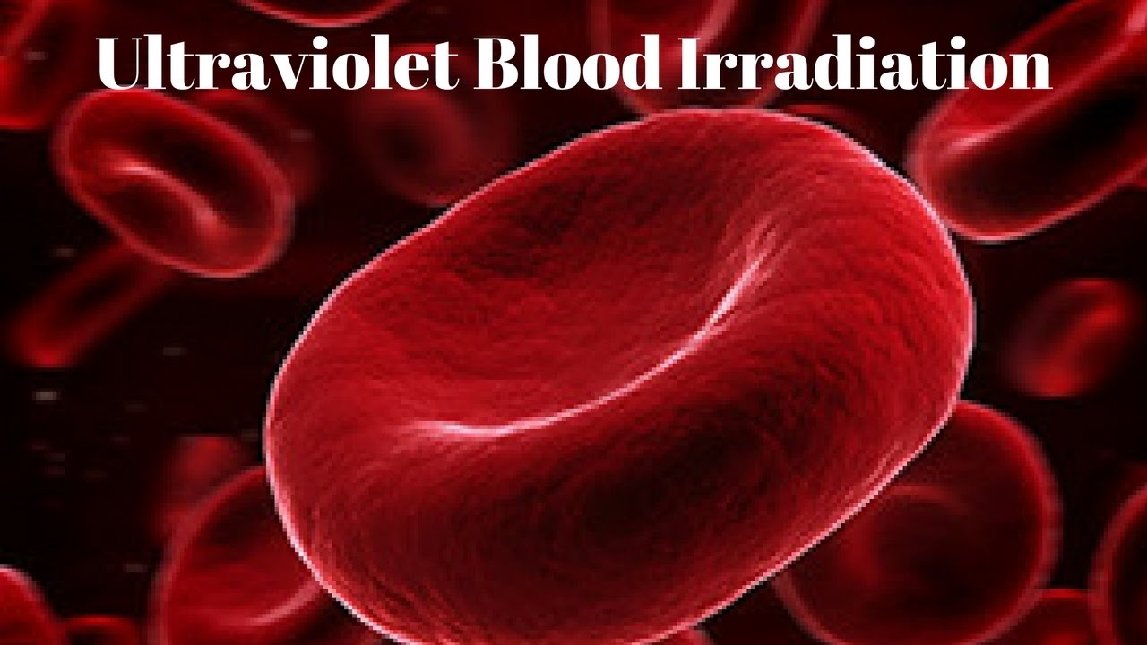 Ultraviolet Blood Irradiation