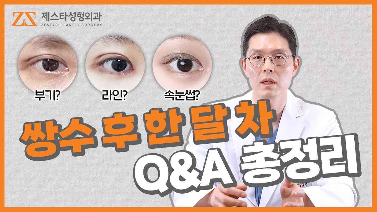 쌍꺼풀 수술 후 부기 때문에 마음고생하시는 분들..😥 조급해 하지 마시고 시청하세요❗ 쌍꺼풀 수술 후 한 달 차 Q&A 총정리