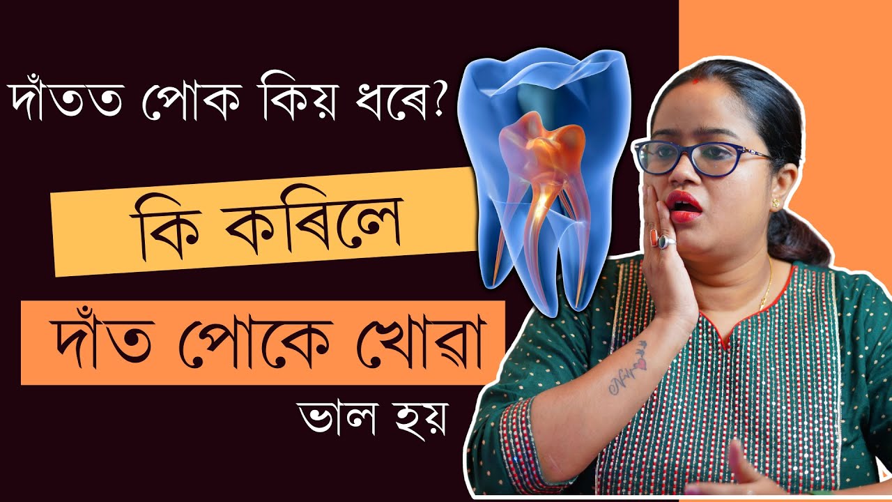 দাঁত পোকে খোৱাৰ আচল কাৰণ কি হয়? কেনেকৈ সহজতে দাঁত পোকে খোৱা ভাল কৰিব পাৰি || Dr. Ponkhi Sharma (PT)