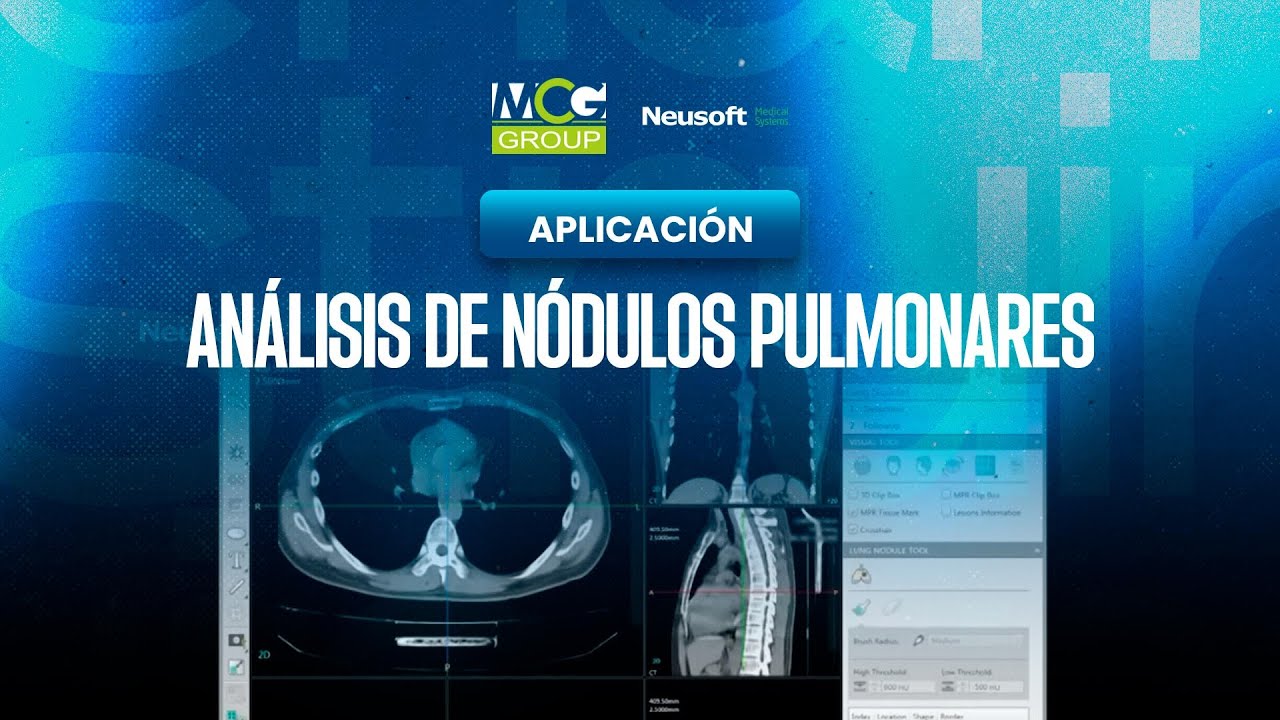Aplicación - Análisis de Nódulos pulmonares