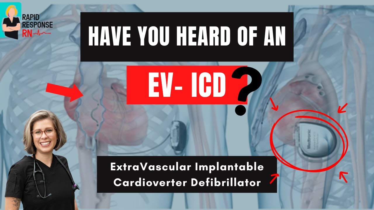 ICDs Explained: Traditional vs S-ICD vs EV-ICD (The Future of Defibrillators!)