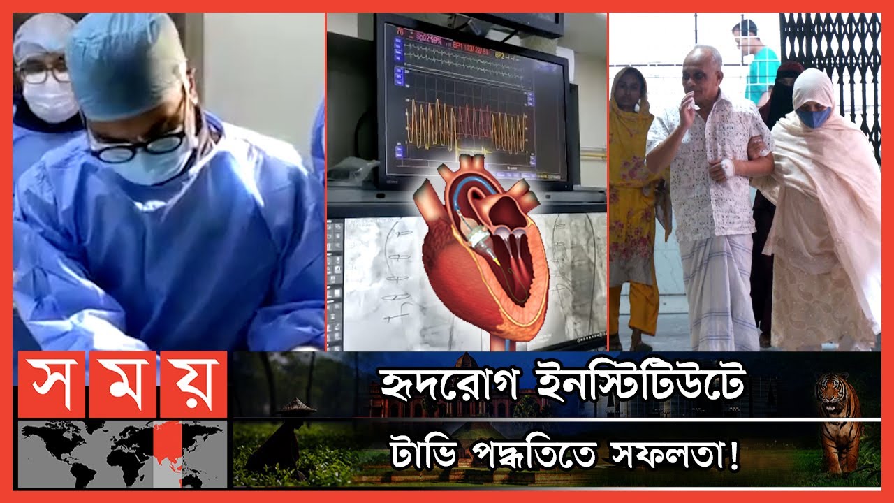 বুক না কে-টে-ই হার্টের ভাল্ব প্রতিস্থাপন ! | TAVI | National Heart Foundation Hospital | Somoy TV