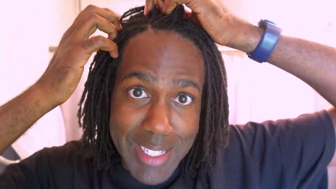 MICROLOCS | SCALP AND DANDRUFF PROBLEMS WITH LOCS ? | How I Manage My Dry Scalp and My Locs