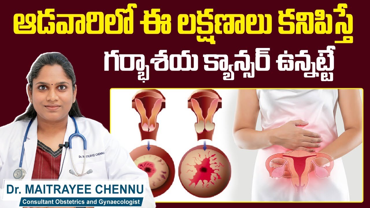 గర్భాశయ క్యాన్సర్ లక్షణాలు | Signs and Symptoms of Cervical Cancer | Cancer Cure | Sankhya Hospitals