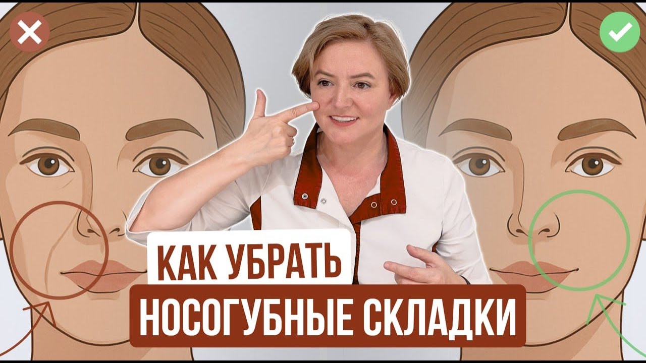Как Убрать Носогубные Складки: 3 полезных и 3 бесполезных способа