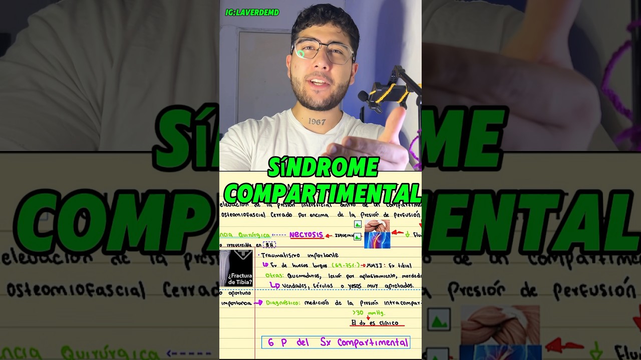 S&Iacute;NDROME COMPARTIMENTAL #medicina