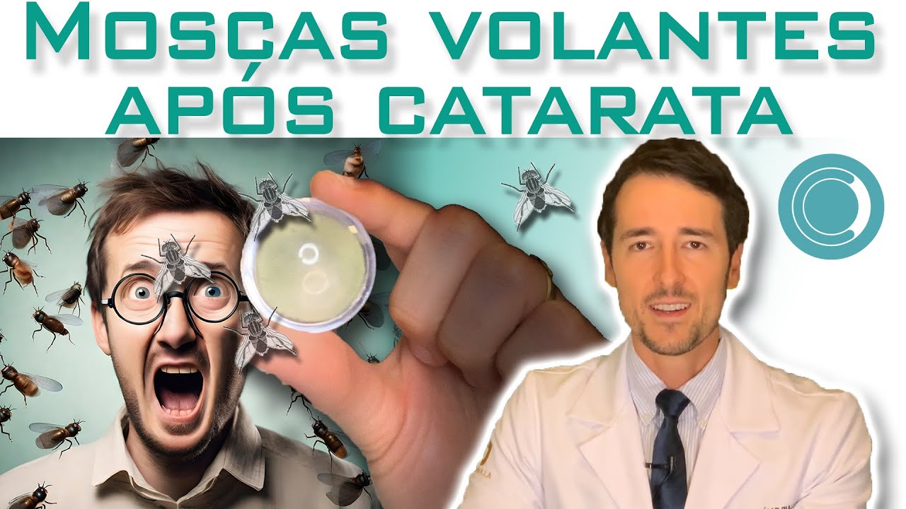 Apareceram moscas volantes após operar catarata - é normal?