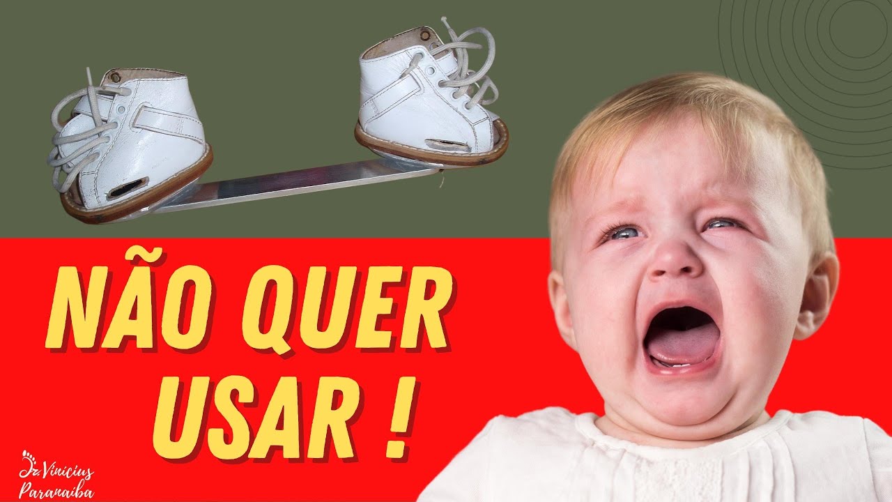 O QUE FAZER PARA SEU FILHO USAR A ÓRTESE DE ABDUÇÃO - "DENIS BROWNE"