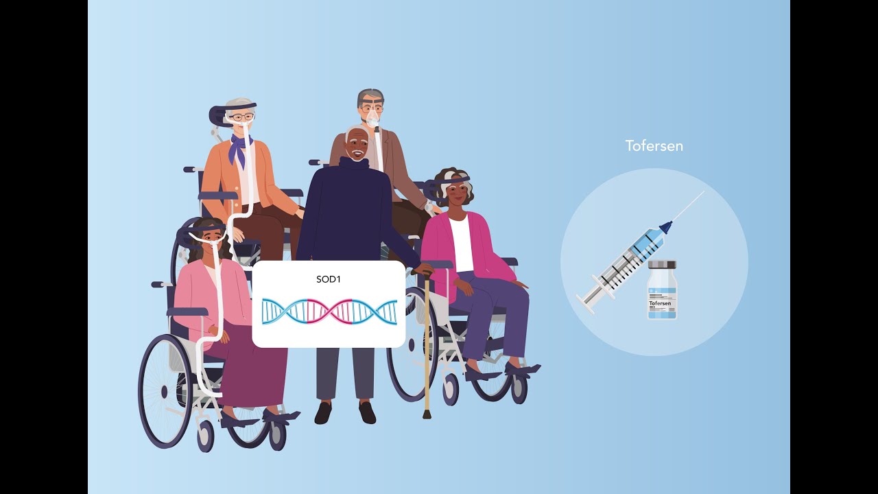 Fighting ALS at the Genetic Level: Real World Results for Tofersen