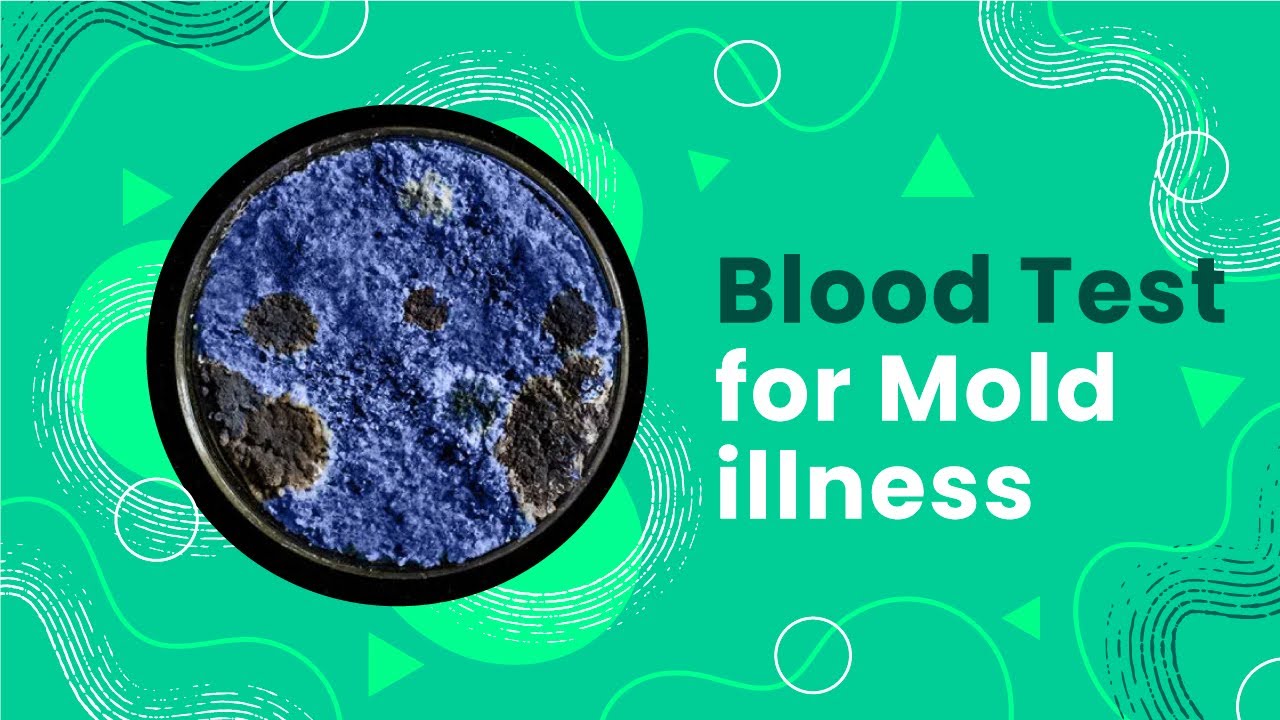 Blood Test for Mold Illness