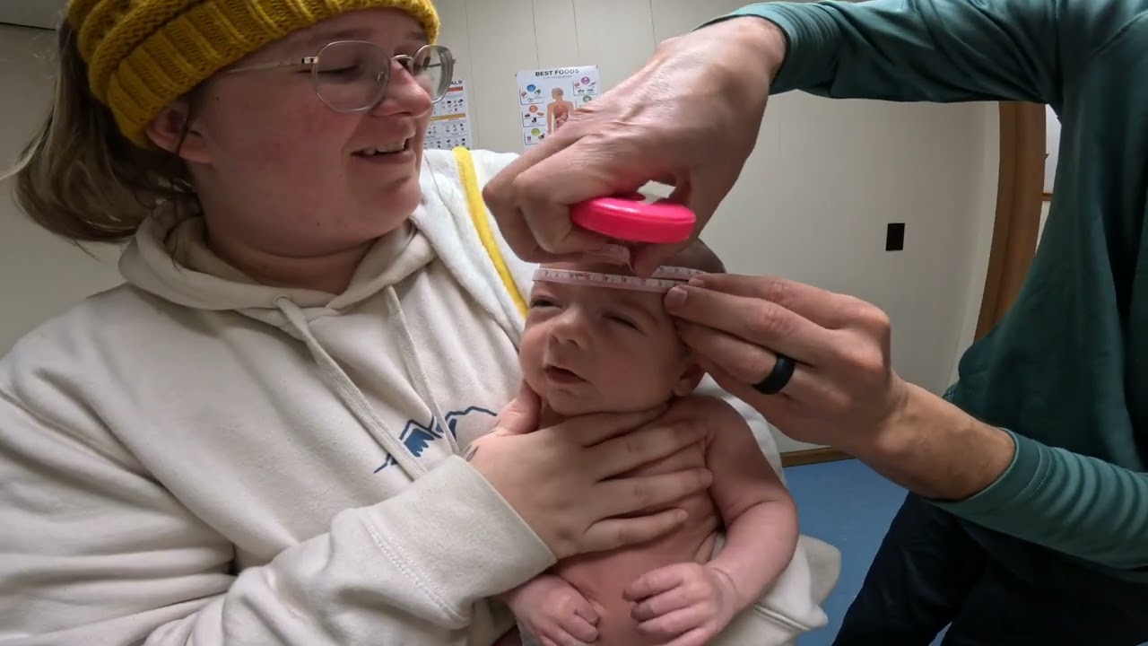 Samsons two month doctor visit