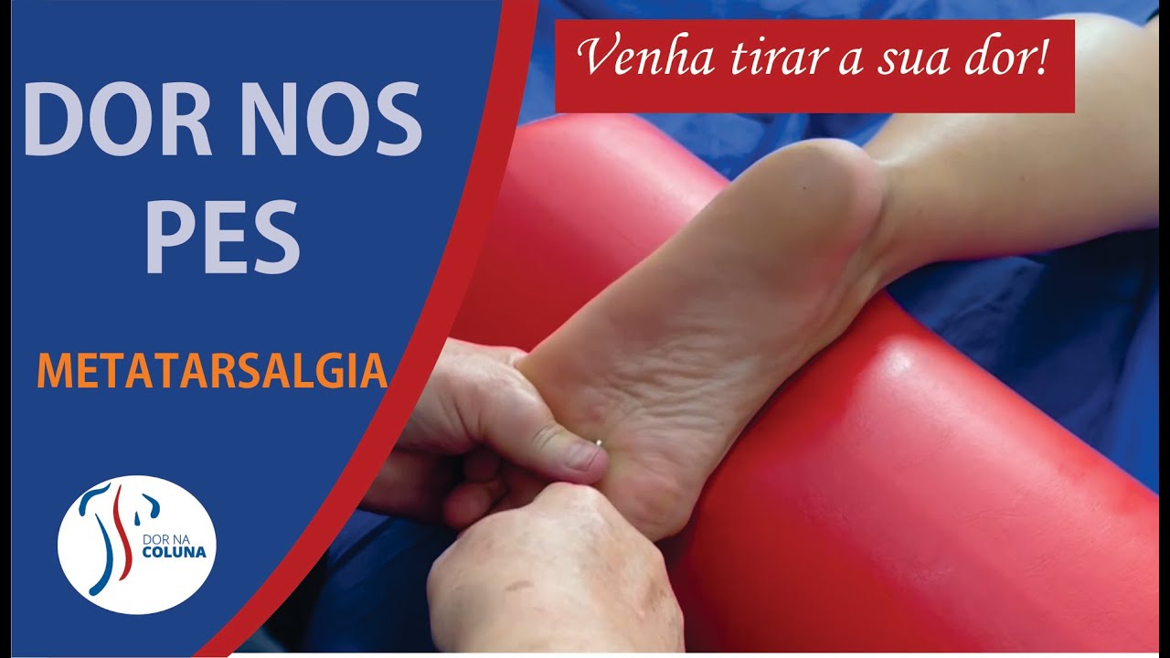 DOR NOS PÉS: Metatarsalgia