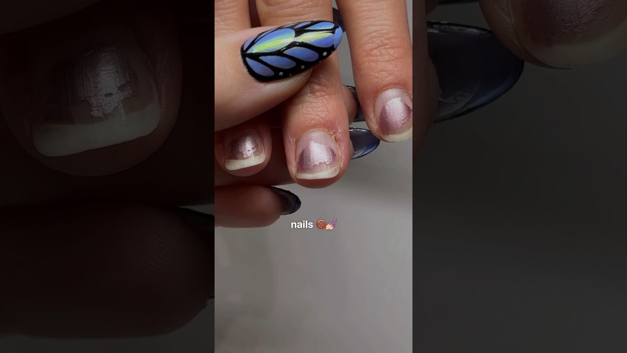 this nail transformation 💯😮&zwj;💨 💅🏻✨ #nails #nailsathome #beforeandafter #transformation #nailart